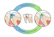 demin and remin cycle