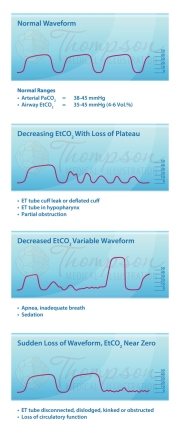 wave forms