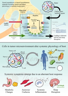 tumor microenvironment