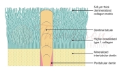 collagen matrix