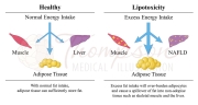 lipotoxicity